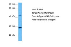 MOBKL2B Rabbit anti-Human, Polyclonal, Novus Biologicals 0.1 mL | Buy Online | Novus Biologicals | Fisher Scientific